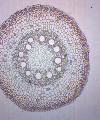 MCS-11Q BOTANY PREPARED SLIDE- ROOT STRUCTURE - DICOT