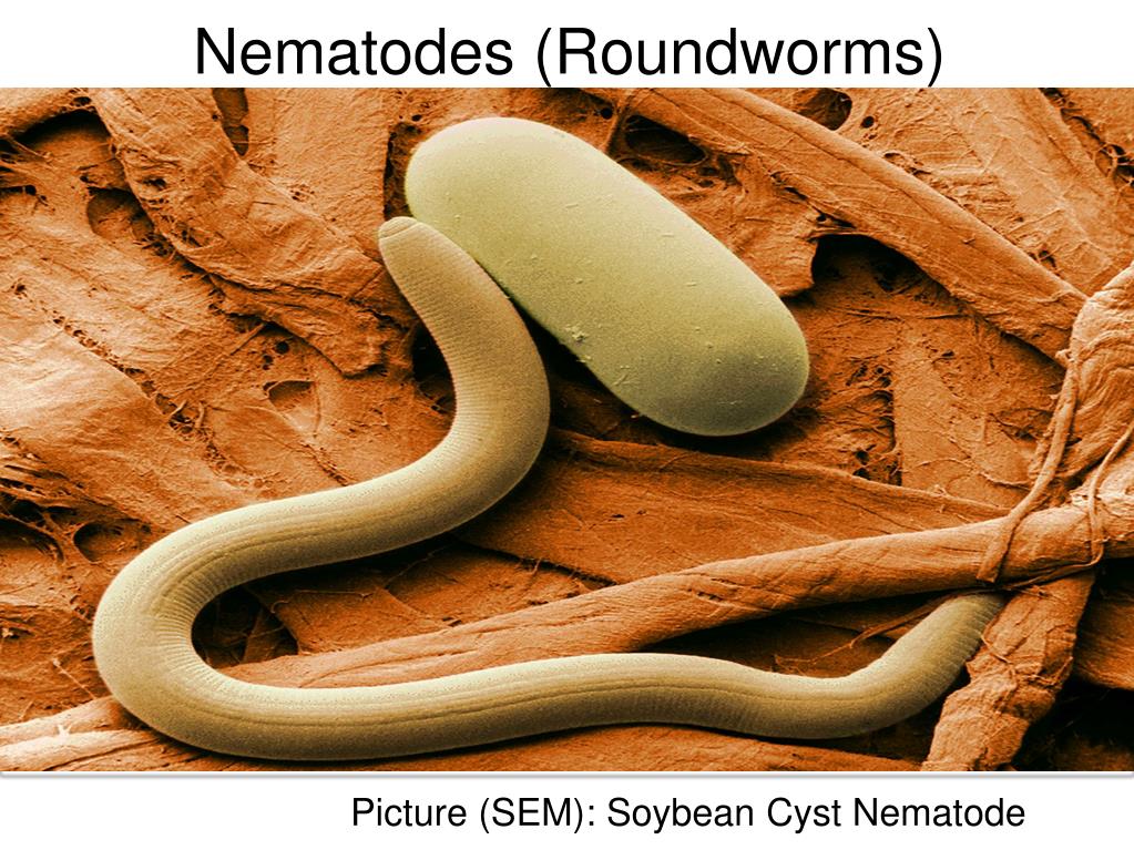 MCS-10F ZOOLOGY PREPARED SLIDES- NEMATODES (ROUND WORMS) MCS-10F ZOOLOGY PREPARED SLIDES- NEMATODES (ROUND WORMS)